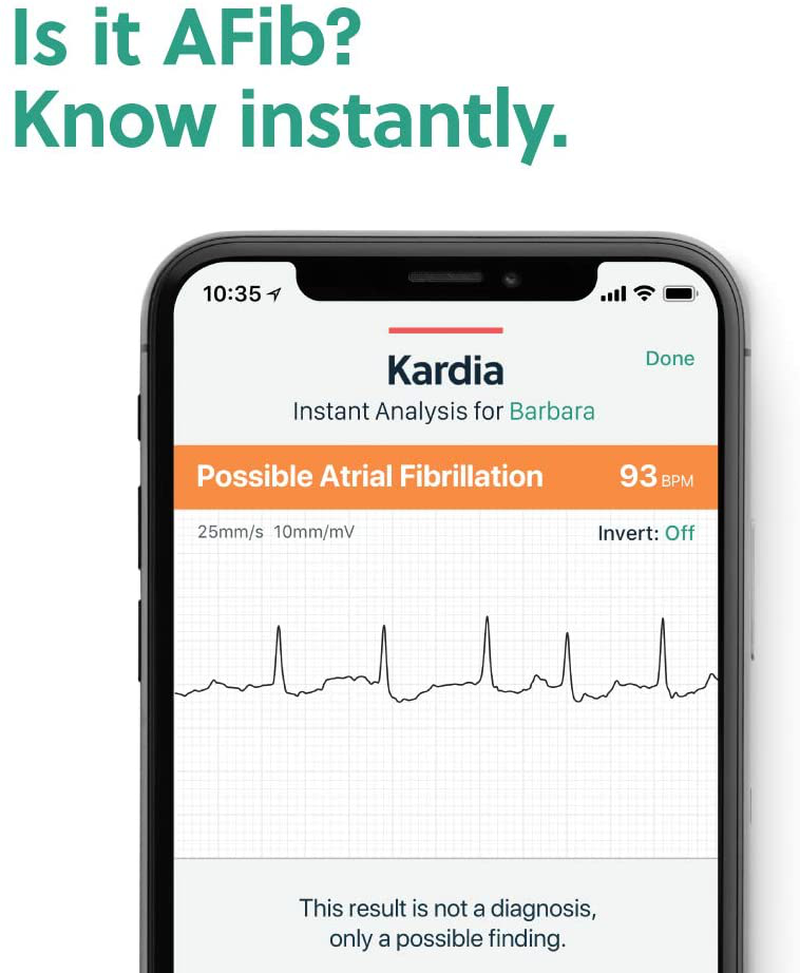 AliveCor® KardiaMobile EKG Monitor - FDA-Cleared 